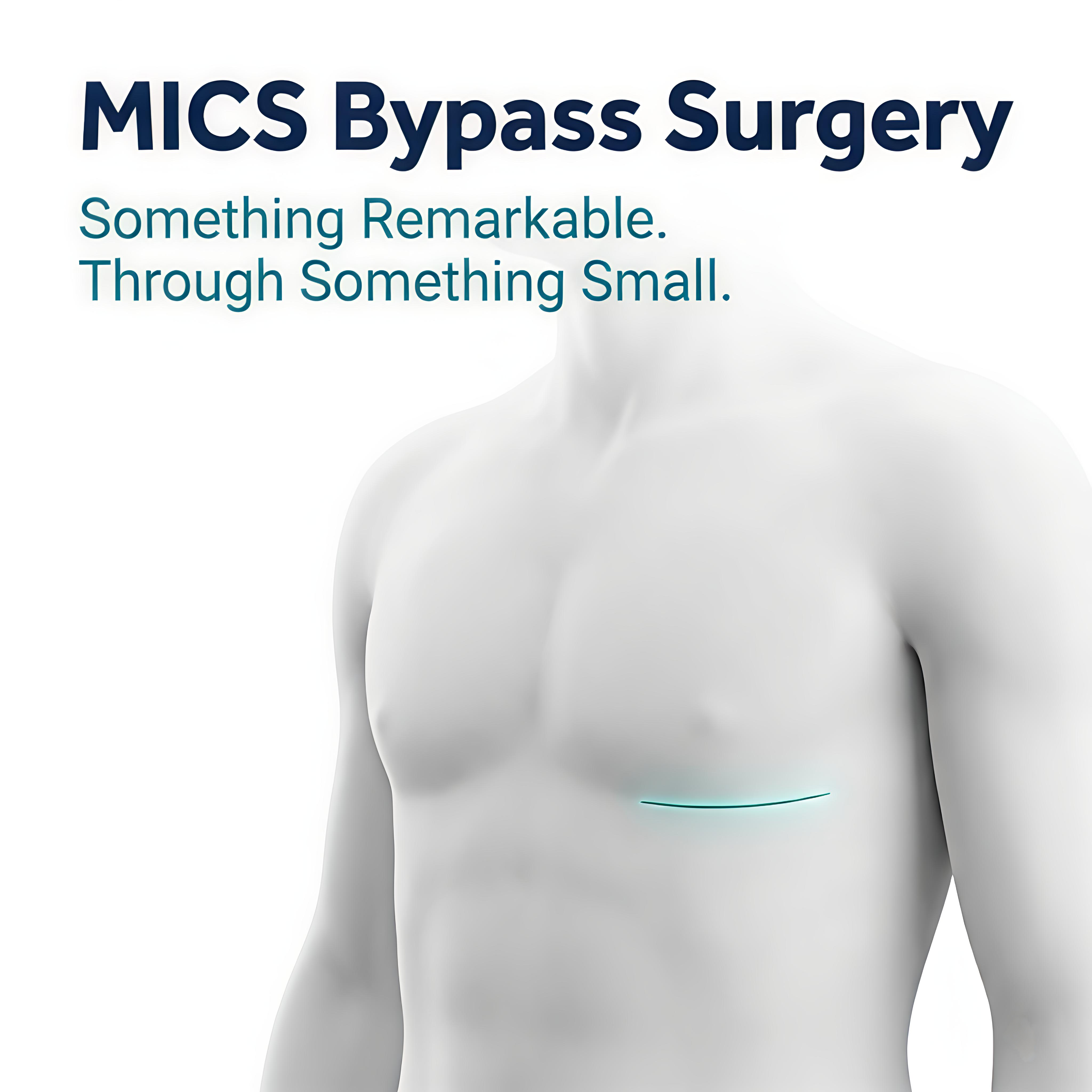 MICS Bypass – Minimally Invasive Bypass Surgery