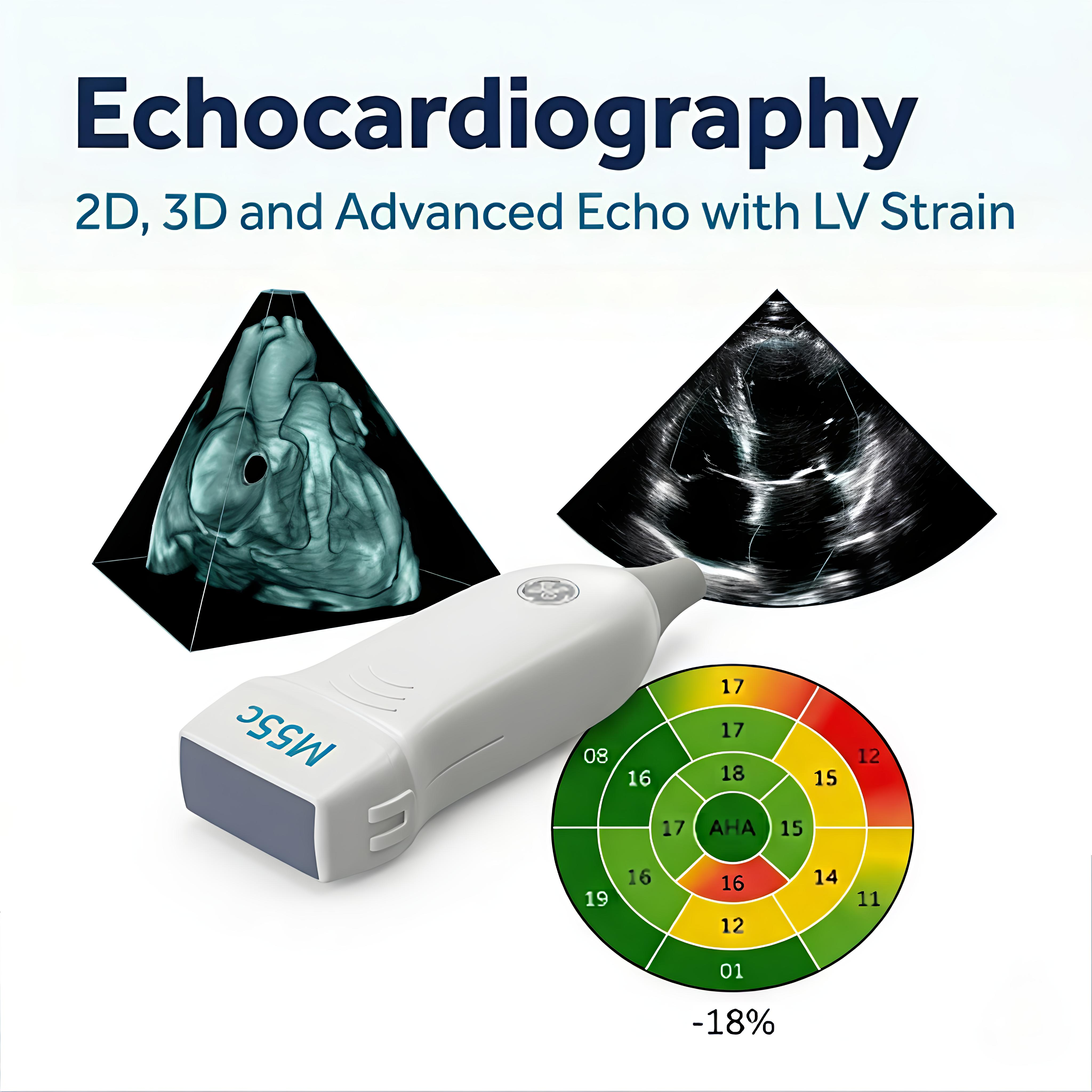 Echocardiography - 2D, 3D and Advanced Echo